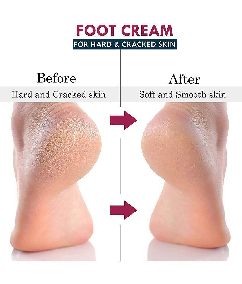 7 FOX Cracked Heel Repair Specialist Cream Smooth Feet, Foot Cream ( 10 mL )