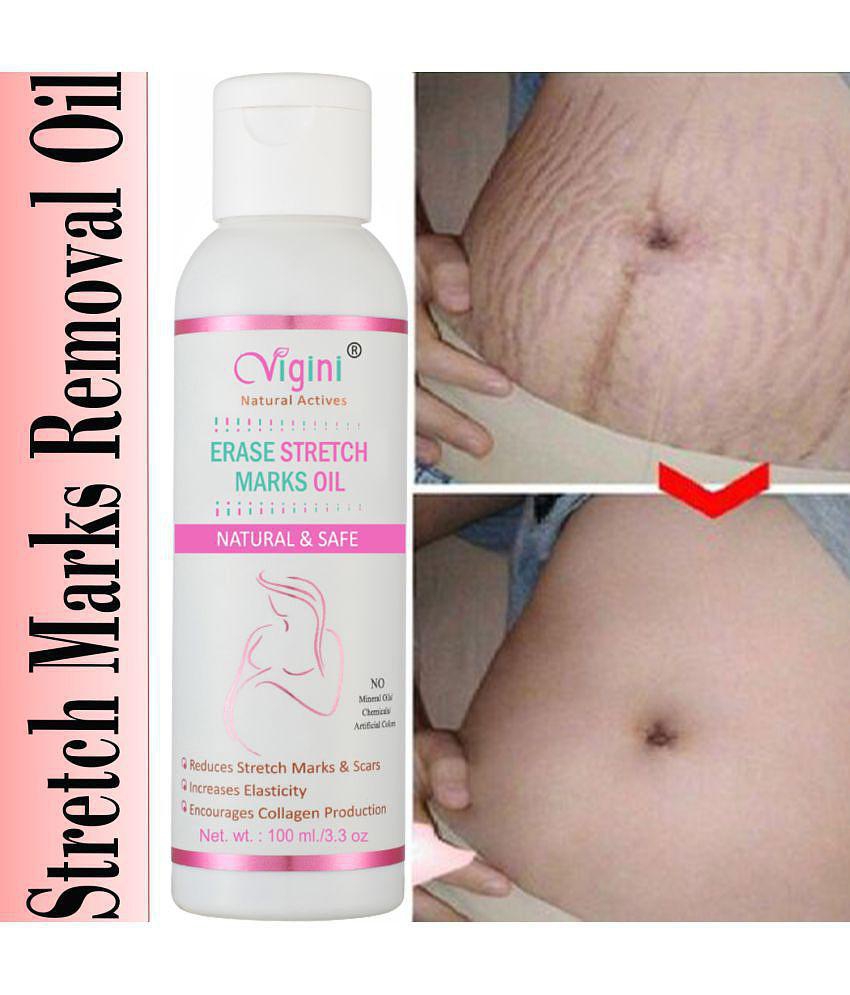 Vigini Stretch Marks Scar removal Bio Oil after delivery women Shaping & Firming Oil 100 mL