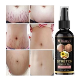 Kuraiy stretch Oil for Stretch Marks Removal Post Pregnancy stretch mark cream oil (50 ml)