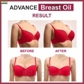 Oilanic Advance Natural Breast Oil 30 ml-30mL