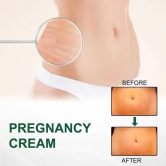 Stretch Mark Cream by Kurai - Perfect for Pregnancy and Postpartum Care