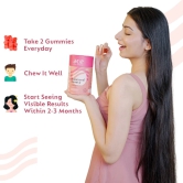 Balanced Beauty Biotin Gummies for Hair Skin and Nails, Helps Reduce Hairfall, Gummies for Hair Growth with Clinically Proven Keranat, Biotin & Multivitamins - 180 Vegan Gummies