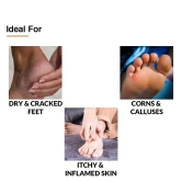 Foot Cream for Cracked Heels | 5% Lactic Acid, 15% Urea, 3% Glycerine-150g