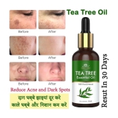 Intimify Tea Tree Essential Oil, Anti Acne Face Oil, Anti Ageing Face Oil, 30 Ml