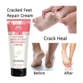 Intimify Foot Crack Cream, Heel Crack Cream, Foot Care Foot Cream ( 50 g )