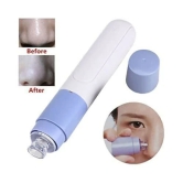 Blackhead Remover – Pore Vacuum Tool for Clear, Smooth Skin