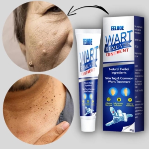 Warts Remover Ointment Cream- ????BUY 1 GET 1 FREE????FLASH SALE