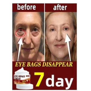 Eye Repair Cream