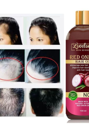 lovelook-anti-hair-fall-onion-oil-100-ml-pack-of-1-