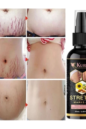 kuraiy-stretch-oil-for-stretch-marks-removal-post-pregnancy-stretch-mark-cream-oil-50-ml