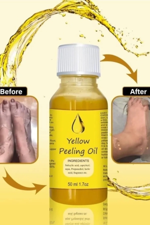 YELLOW®- PEELING OIL FOR DARK SKIN ??????????4.8/5 (12,600+ REVIEW)