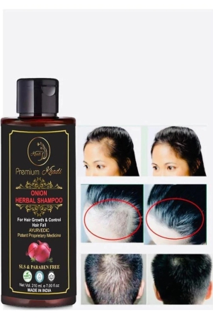 premium-khadi-onion-shampoo-for-hair-growth-with-aloevera-argan-oil-sls-paraben-free-shampoo-210-ml