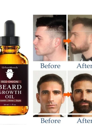 urbanmooch-30ml-growth-increasing-beard-oil-pack-of-1