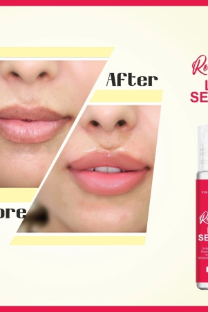 lip-serum-roll-on-advanced-brightening-therapy-for-soft-moisturised-lips-with-glossy-shine-10ml-free-size