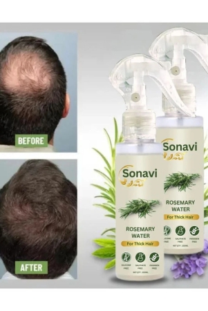 sonavi-anti-dandruff-rosemary-oil-200-ml-pack-of-2-