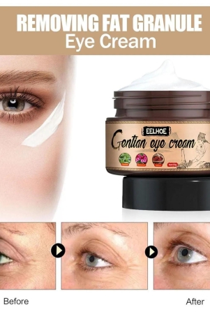 gentle-eye-cream-for-eye-bags-puffiness-wrinkles-removal