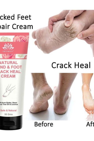 intimify-foot-crack-cream-heel-crack-cream-foot-care-foot-cream-50-g-