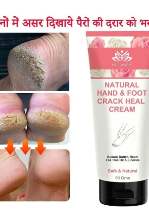 intimify-cracked-skin-repair-feet-cream-foot-cream-chapped-hand-and-foot-cream-50-gms