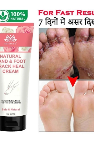 intimify-crack-heal-cream-foot-crack-cream-skin-repair-cream-heel-crack-cream-50-gms