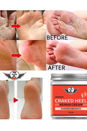 7-fox-cracked-heel-repair-specialist-cream-smooth-feet-foot-cream-10-ml-