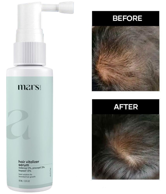 Mars by GHC Redensyl & Procapil Hair Serum 60 mL