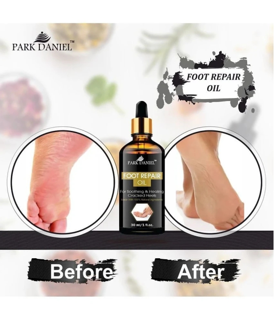 Park Daniel Foot Repair Oil  For Cracked Heels Foot Lotion ( 30 mL )