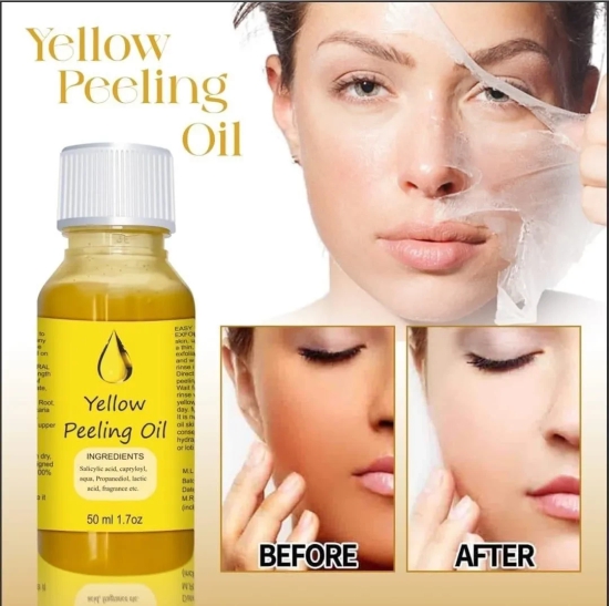 YELLOW®- PEELING OIL FOR DARK SKIN ??????????4.8/5 (12,600+ REVIEW)