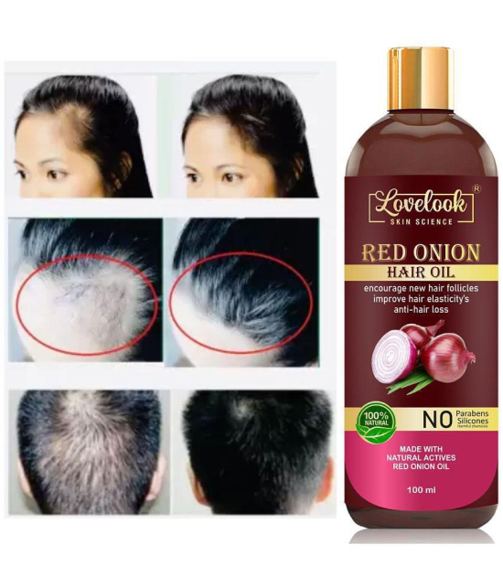 Lovelook - Anti Hair Fall Onion Oil 100 ml ( Pack of 1 )