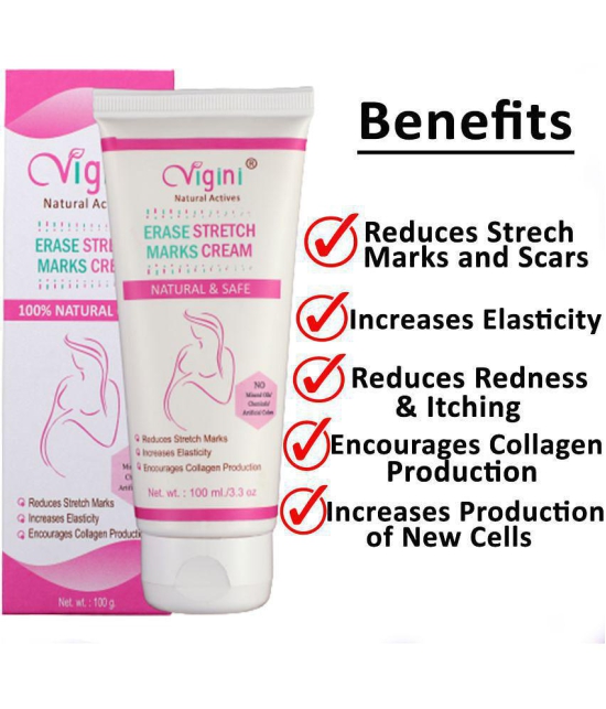 Vigini Natural Stretch Marks Removal Cream for Skin Tightening Shaping & Firming Cream 100 g