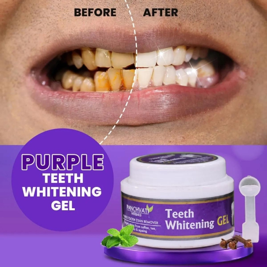 Purple Teeth Whitening Gel-1