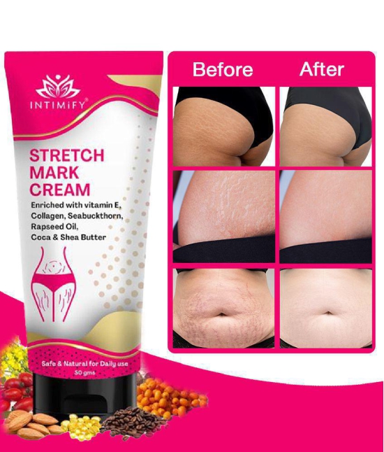 Intimify Stretch Mark Cream Stretch Mark Remover Cream Shaping & Firming Cream 50 g