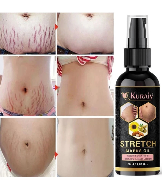 Kuraiy stretch Oil for Stretch Marks Removal Post Pregnancy stretch mark cream oil (50 ml)