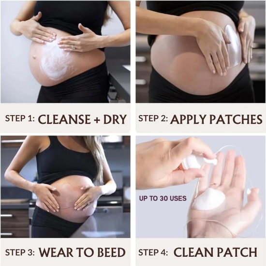 Silicone Anti Stretch Mark Stomach Patch