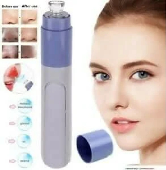 Blackhead Remover – Pore Vacuum Tool for Clear, Smooth Skin