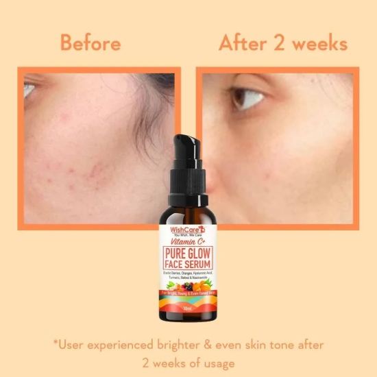 Vitamin C+ Pure Glow Serum- 30 ml