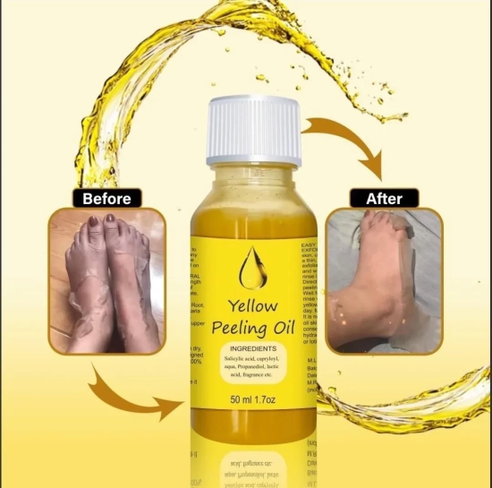 YELLOW®- PEELING OIL FOR DARK SKIN ??????????4.8/5 (12,600+ REVIEW)