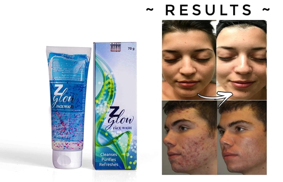 Z Glow facewash for oily & acne prone skin, 70gm