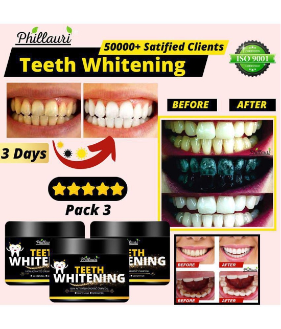 Phillauri Phillauri Teeth Whitening Denture Oral Kit