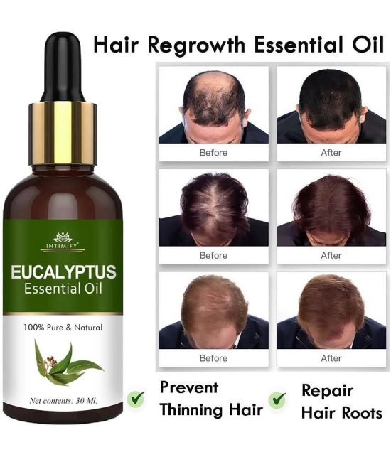 Intimify Eucalyptus Essential Oil, Hair Growth Oil, Hair Inhabiter Oil, Hair Loss Oil, 30 Ml