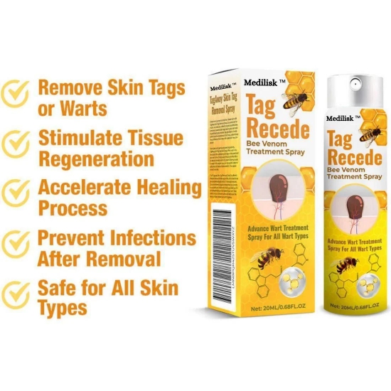 Bee Venom Wart Remover Spray 30ml-Pack of 1