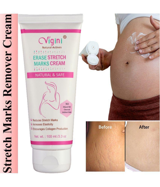 Vigini Natural Stretch Marks Removal Cream for Skin Tightening Shaping & Firming Cream 100 g