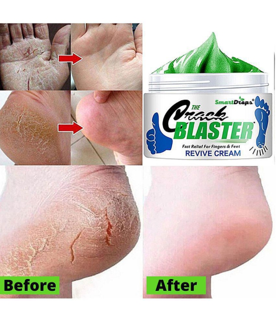 Smartdrops Chapped Hand And Foot Cream Crack Peeling Repair Anti Dry Skin Remove Dead Skin Foot Moisturizing (50gm) (For Women and men) Pack of 2