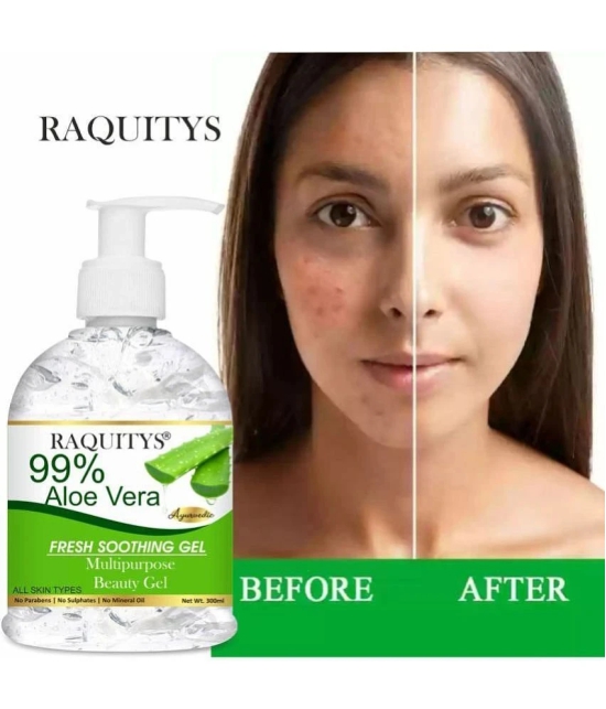 RAQUITYS Moisturizer All Skin Type Aloe Vera ( 300 ml )