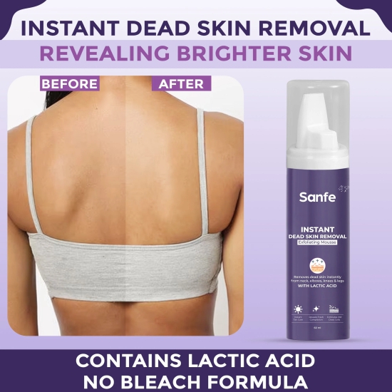 Sanfe Instant Dead Skin Removal Exfoliating Mousse - 60 ml-Sanfe Instant Dead Skin Removal Exfoliating Mousse - 60 ml