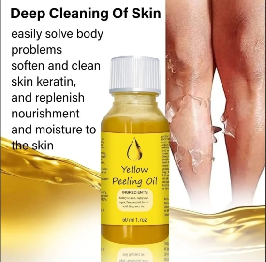 YELLOW®- PEELING OIL FOR DARK SKIN ??????????4.8/5 (12,600+ REVIEW)