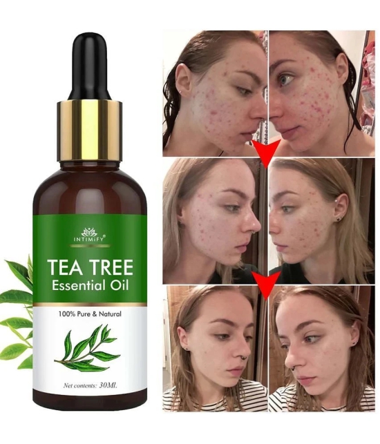 Intimify Tea Tree Essential Oil, Anti Acne Face Oil, Anti Ageing Face Oil, 30 Ml