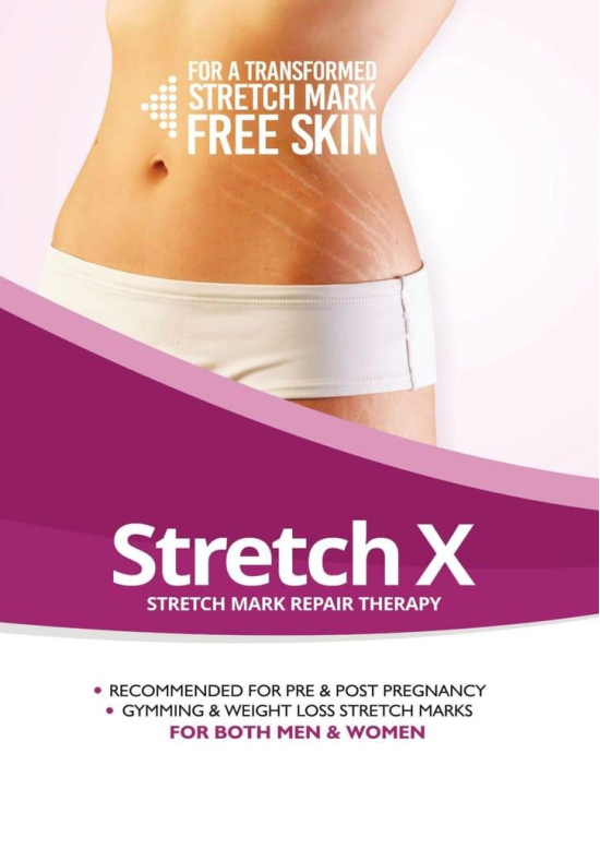 STRETCH X Stretch Mark Cream | Stretch Marks Remover Cream in Pregnancy | Weight Loss Stretch Marks | For all skin - 75 ml