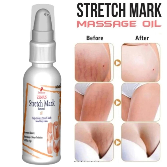 Zenius Stretch Mark Oil for All Skin Types-Pack of 3