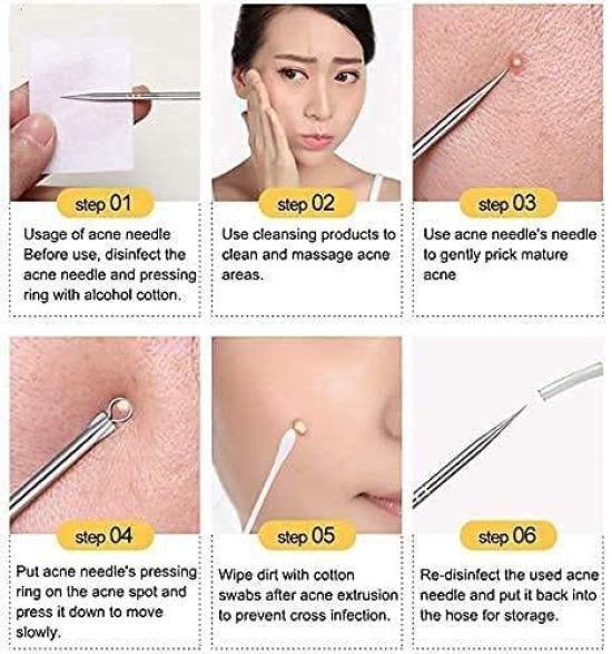 Aadav Stainless Steel Blackhead Pimple Blemish Extractor/Remover Tool With 6 Pcs Ear Cleansing Tool Set, Spring Ear Wax Cleaner Tool Set,Ear Curette Ear Wax...