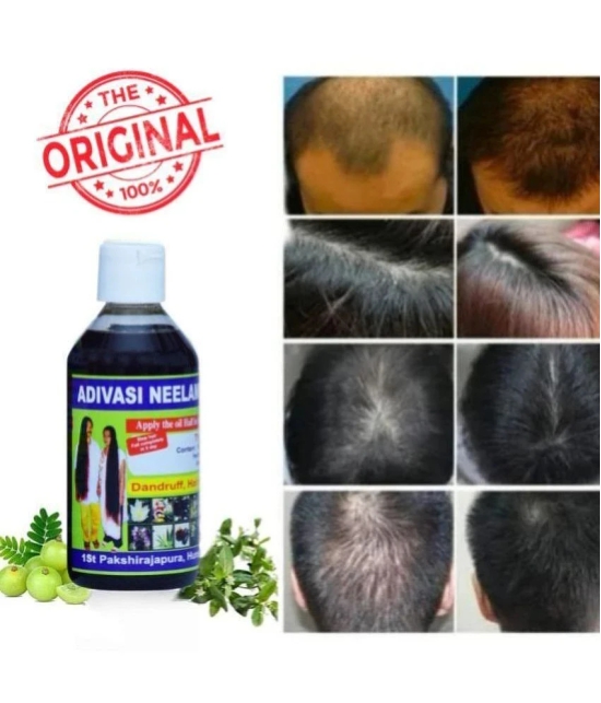 Growkesh Anti Hair Fall Amla Oil 100 ml ( Pack of 1 )